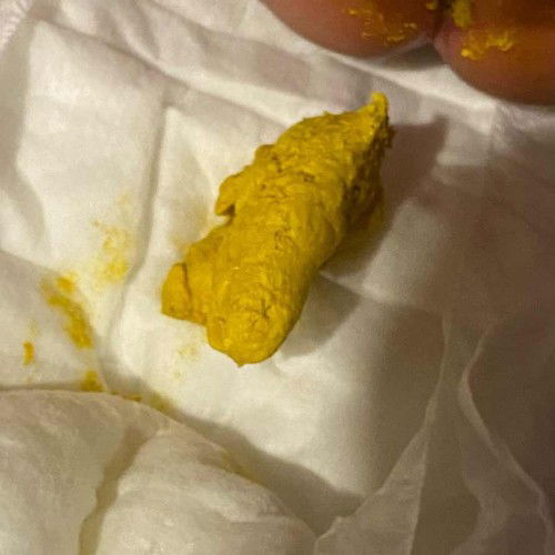 อึแบบนี้ไม่ถูกกับนมมั้ยค่ะ