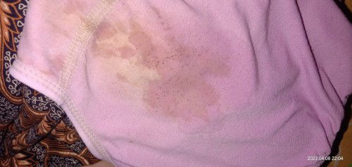 Ketuban rembes atau keputihan ya bund?