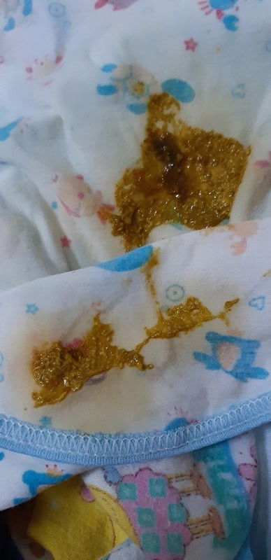 BAB bayi seperti ini normal tidak ya bun ?