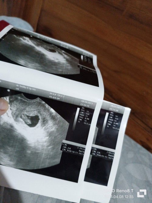 DJJ BERHENTI 😭😭