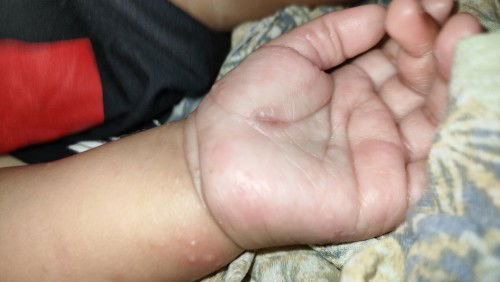 Bantu sharing bunda, ada ga adik ny pernah seperti ini, sdh juga di bawa ke DS kulit