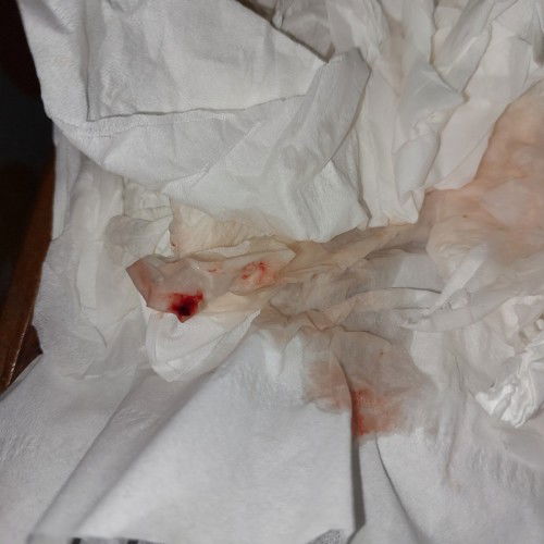 HPL 13 APRIL keluar lendir darah