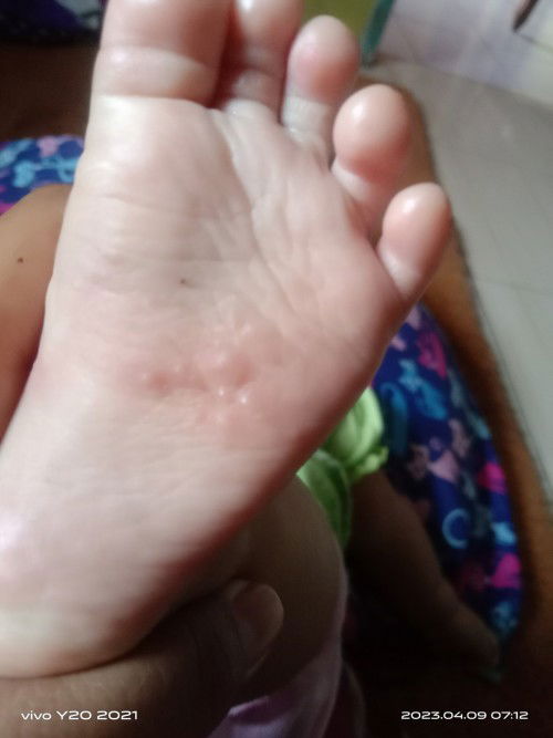 Rekomend salep ny dongbun