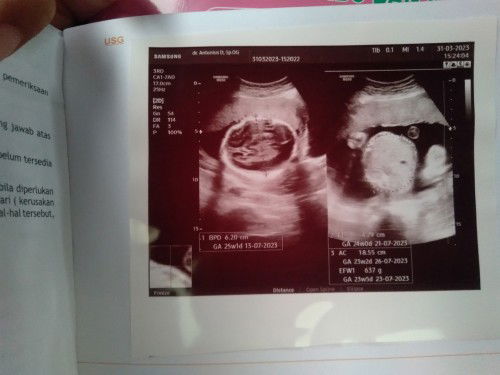 Referensi nama baby.