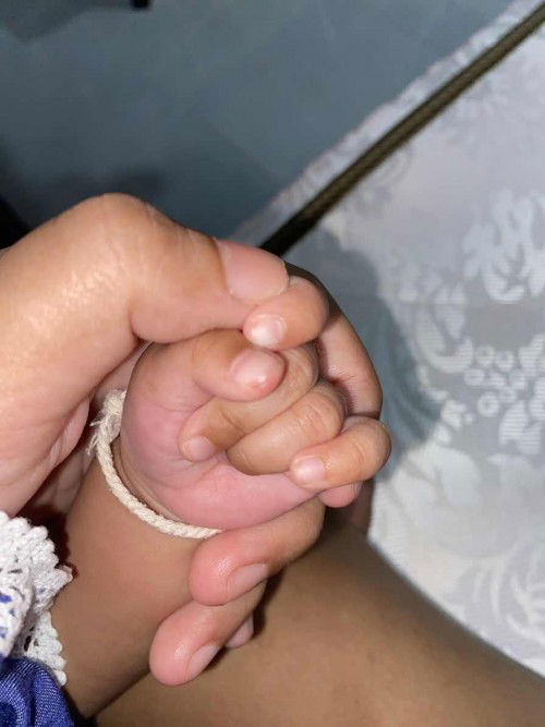 เผลอตัดเล็บเข้าเนื้อลูก  เลือดออกเลยค่ะ