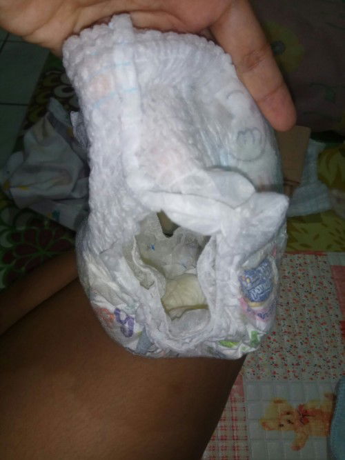 bayi 4.5 bulan pipisnya sedikit