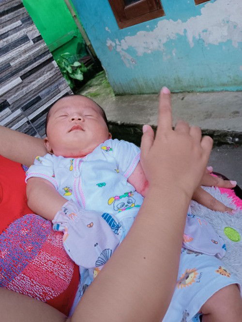 Awalnya biang keringat lalu disuruh pakai bedak caladine sm bidan malah jadi lecet merah