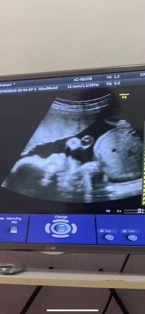 ขอสอบถามเเม่ๆหน่อยค่ะ