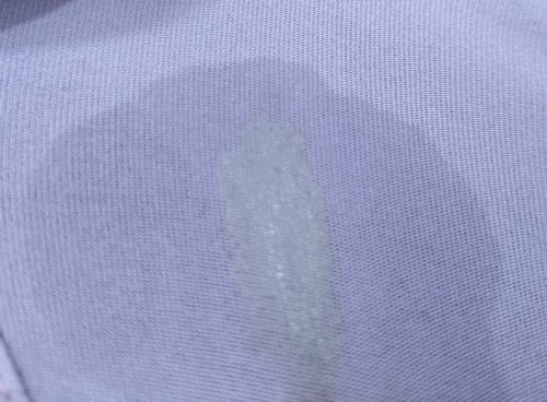 มีตกขาว มีมูกใสนิดๆ มีน้ำใสไหลนิดหน่อย ท้องแข็งถี่เป็นบ้างเวลา