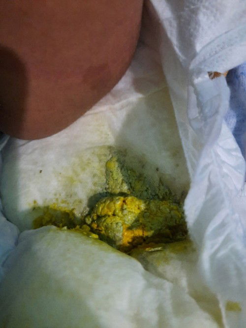 Pup bayi warna nya beda dari biasanya