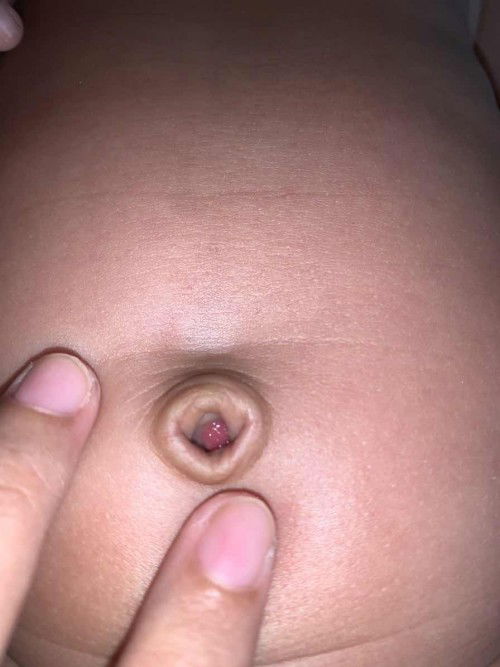 Pusar ada merah merah