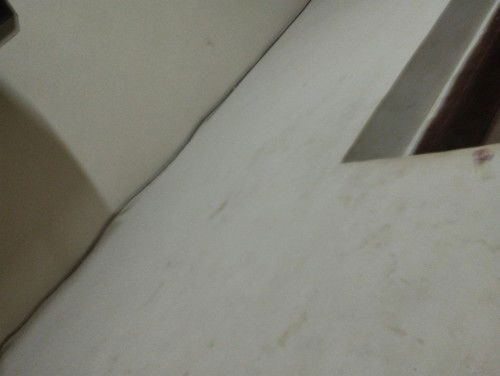 Ada yang sama gak bun  , .setelah melahirkan pas kencing sakit ,kayak anyang* en gitu