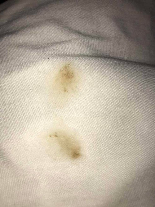 Sticky brownish discharge