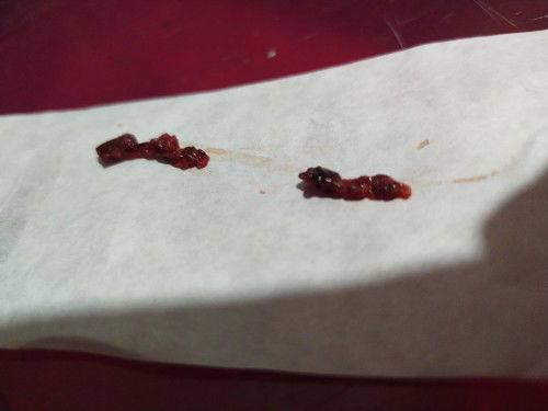 Menstruasi apa bisa Hamil ????