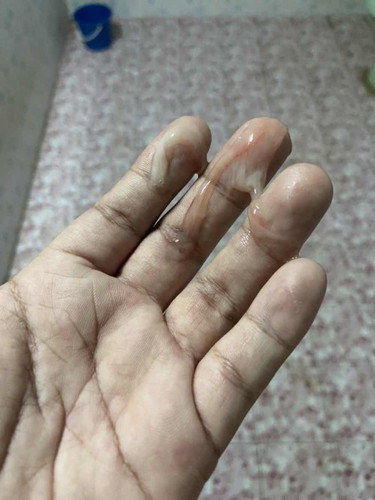 มีมูกออกแบบนี้ไปโรงบาลเรยไหมคะ