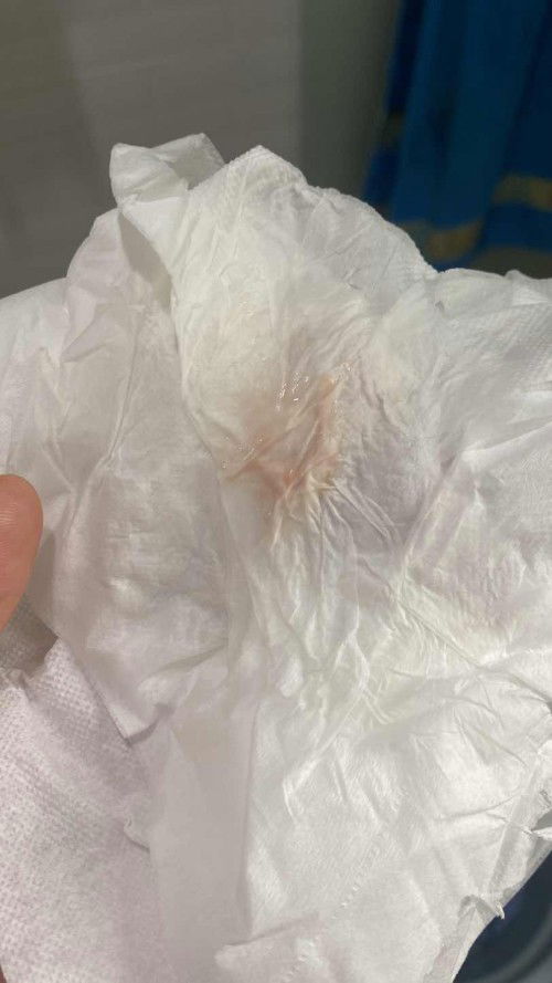 Keputihan campur lendir + warna pink