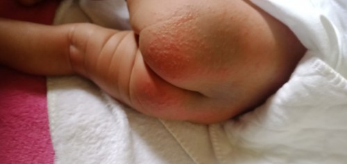 Mga butol sa pwet n bby