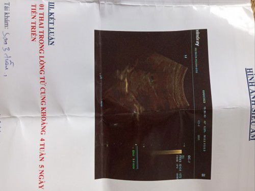 Các mom ơi e bầu 3 tháng đầu có được ăn hải sản không ạ