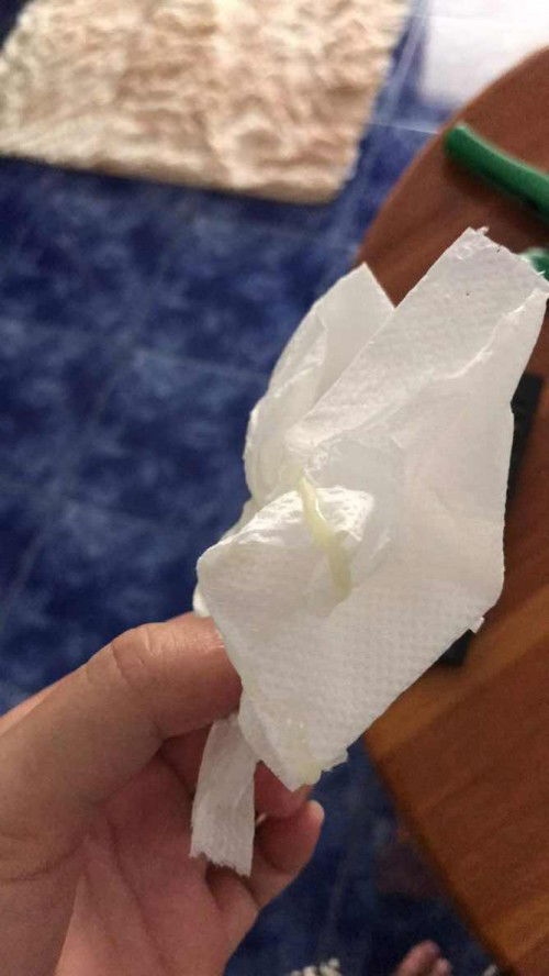 แบบนี้ต้องไปรพ.ไหมคะ ท้องแรก37+5