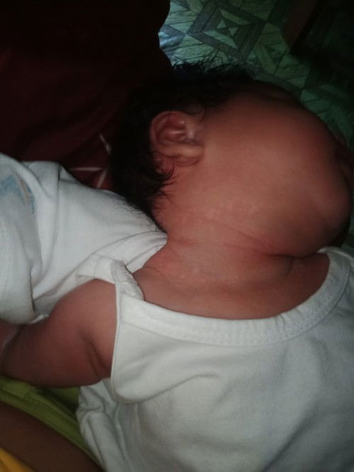 An an sa leeg ni baby