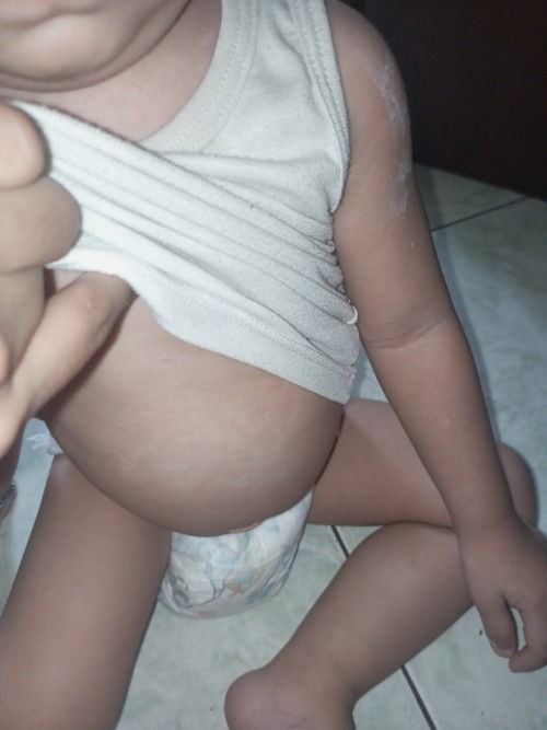 Kenapa ya Bun badan anak saya merah2 kyk gini?