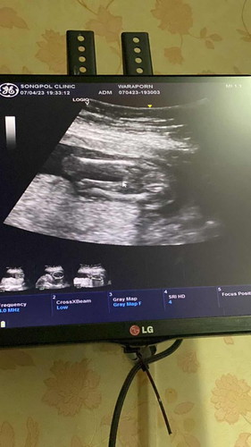 18 วีค กับการลุ้นเพศลูก