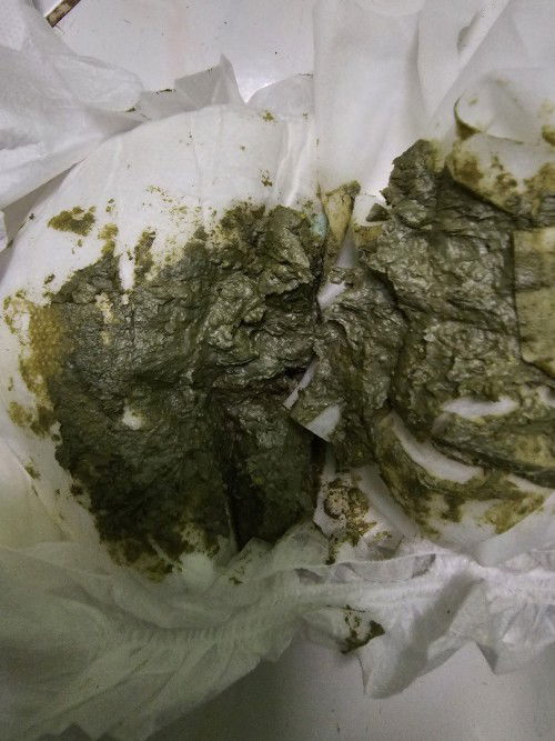 Normal ke najis baby nie