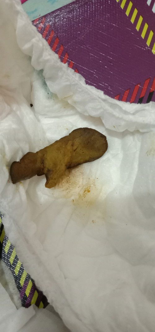 Warna dan bentuk poop Bayi