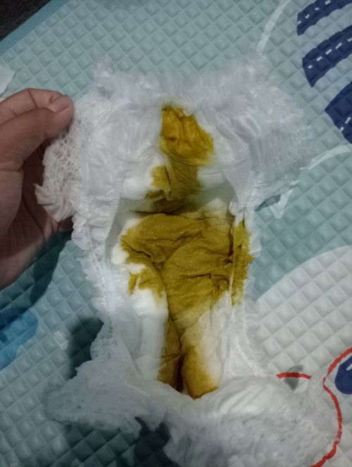 Pup bayi encer tp gak diare sehari bab 1-2x