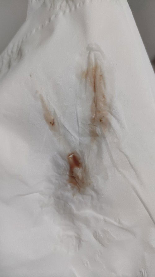 39+2 แล้วค่ะ