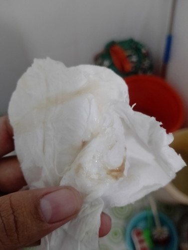 Ra như này là gần chuyển dạ phải không các mom