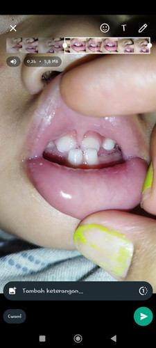 Liptie bukan