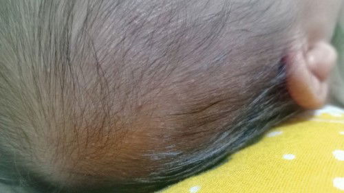 bintik putih kyk jerawat