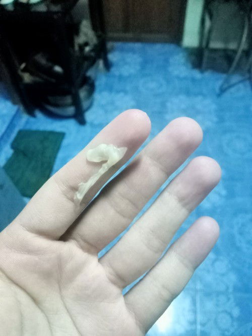 แบบนี้ใช่มูกมั้ยคะ?