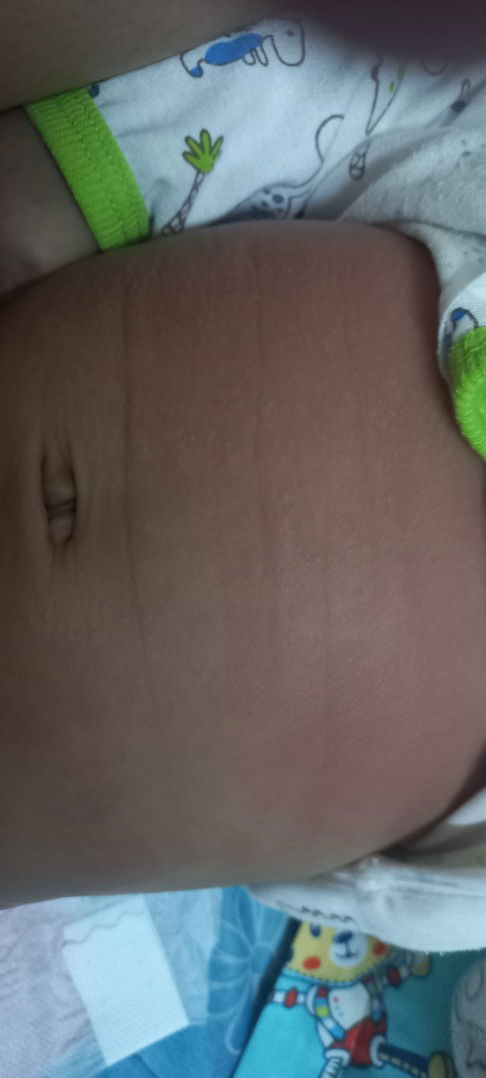 Kulit baby macam bersisik