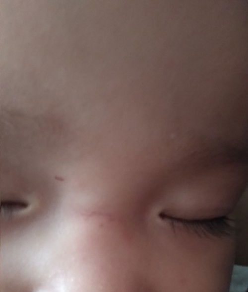 Anak jatuh dan terbentur meja