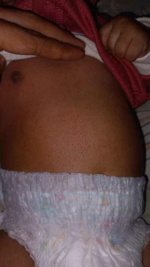 Bintik2 merah 1 badan