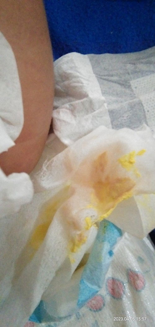 Feses bercak merah muda