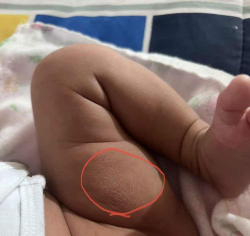 ช่วยแนะนำครีมหน่อยค่ะ