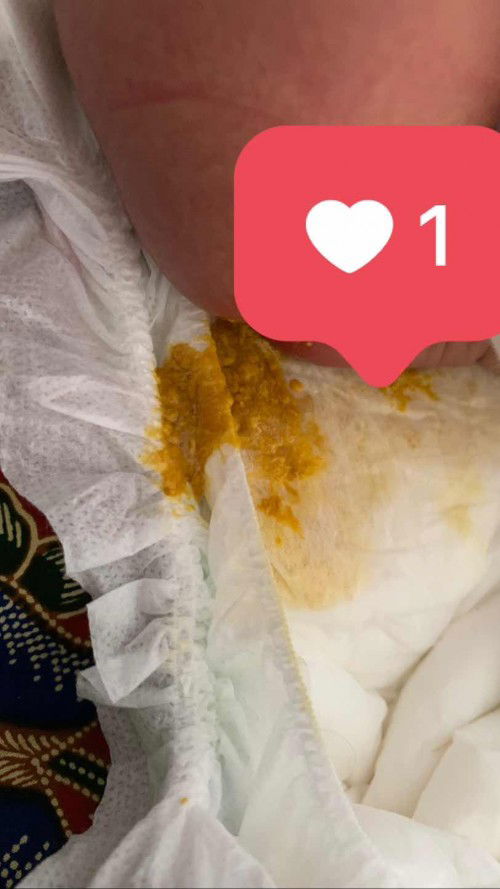 Normal ke najis macam ni atau bby cirit?