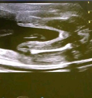 Hi mommy..