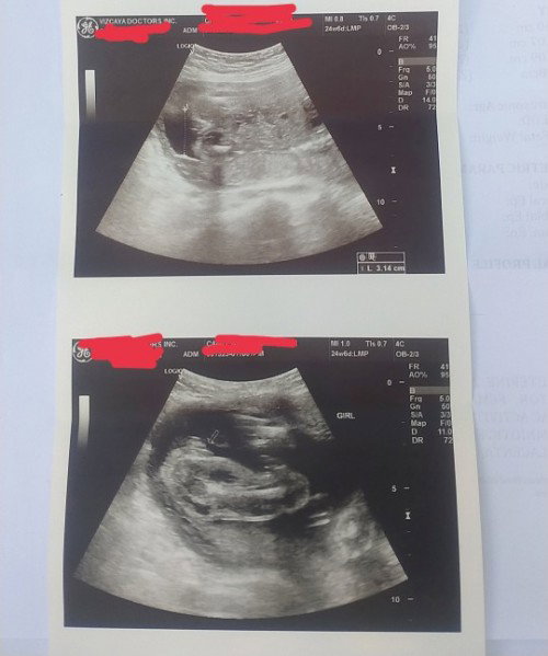 Baby girl?