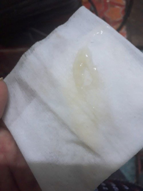 มูลใสๆแบบนี้ใก้ลหรือยังค่ะตอนนี้39+แล้วค่ะ