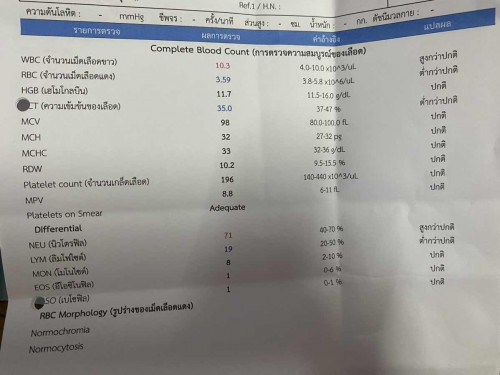 ผลการตรวจเบาหวาน