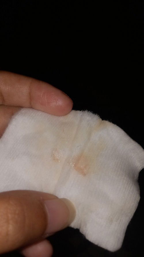 Apakah ini tanda2 melahirkan ya Bun..tp blom ada kontraksi cuma perut keras aja