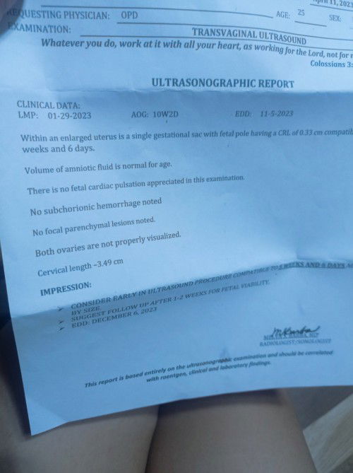 No subchorionic hemorrhage