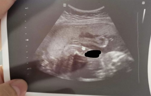 Gender ni Baby