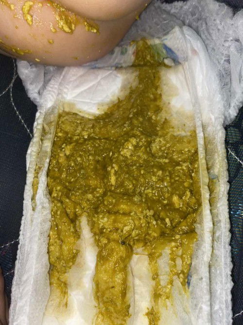 BAB anak ASI+Sufor BEBELOVE