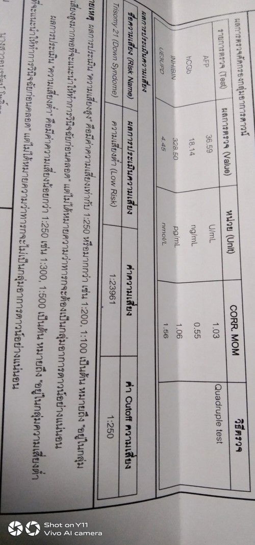 วันนี้ไปฟังผลเลือดมาหมอบอกมีภาวะเสี่ยงต่ำนิ้ดเดียว  แบบนี้จะมีผลเป็นดาวน์มั้ยคะ กังวลและเครียดมากค่ะ