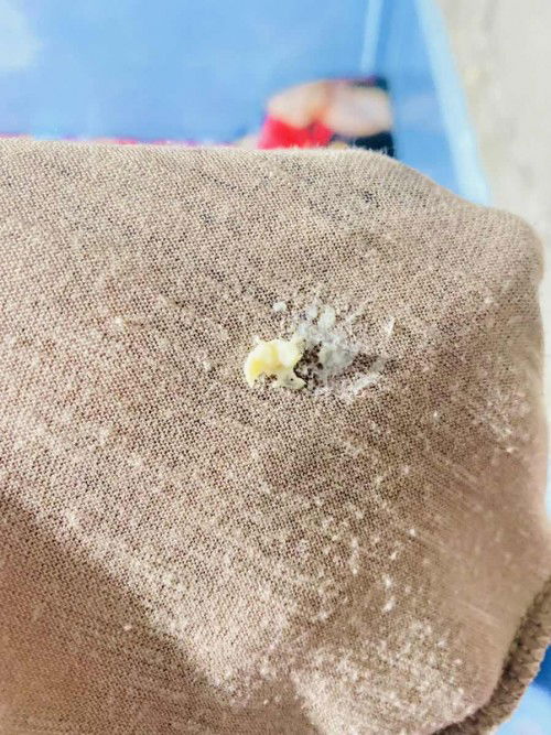 ขอสอบถามหน่อยค่ะ พอดีมีตกขาวเเบบนี้เยอะเกิดจากอะไรค่ะ อันตรายไหม ใครรู้ช่วยตอบหน่อยนะคะ (ขออภัยถ้าน่าเกียจ)